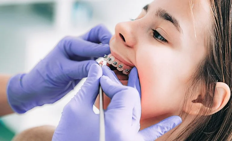 Orthodontics