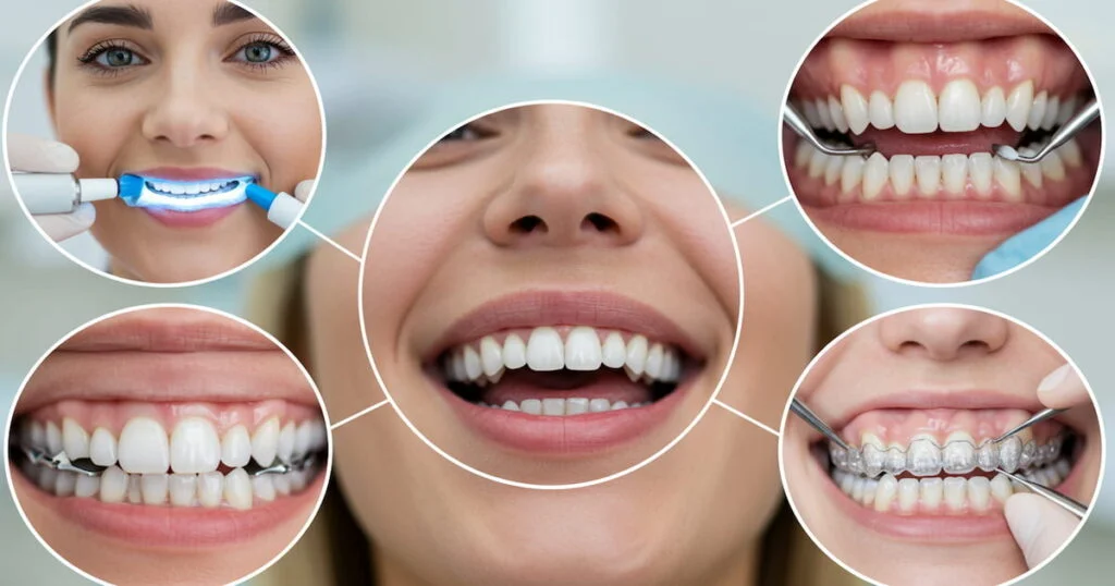 Cosmestic Dentistry
